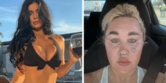 أظهرت أماندا بينز تغييرًا كبيرًا بعد إجراء أسلوب Kylie Jenner المثير للجدل