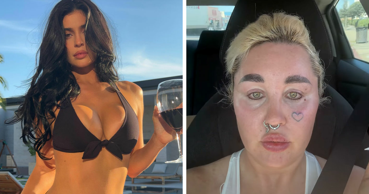 أظهرت أماندا بينز تغييرًا كبيرًا بعد إجراء أسلوب Kylie Jenner المثير للجدل