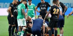ماديسون للخضوع لعملية جراحية بعد تمزق ACL