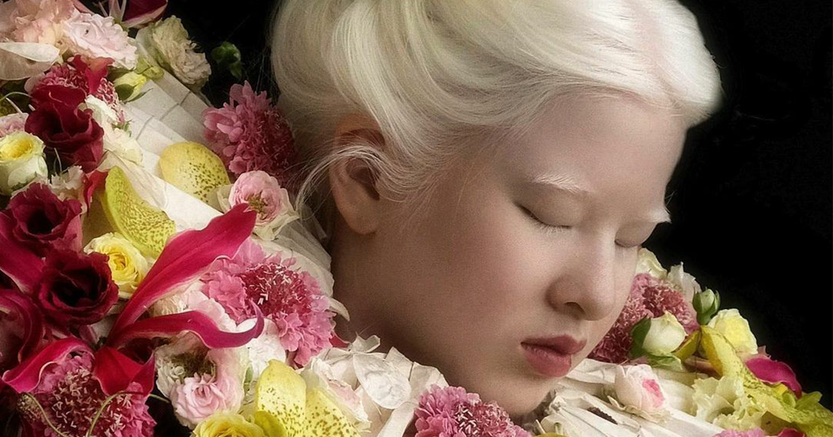 تم التخلي عنها عندما كانت طفلة بسبب المهق، ونمت Xueli لتصبح عارضة أزياء رائجة (25 صورة)